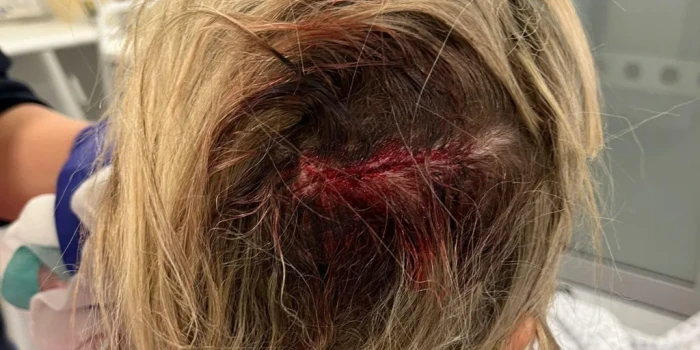 «Այնքան բախտավոր եմ, որ ողջ մնացի ծակող երկաթով հարձակումից»